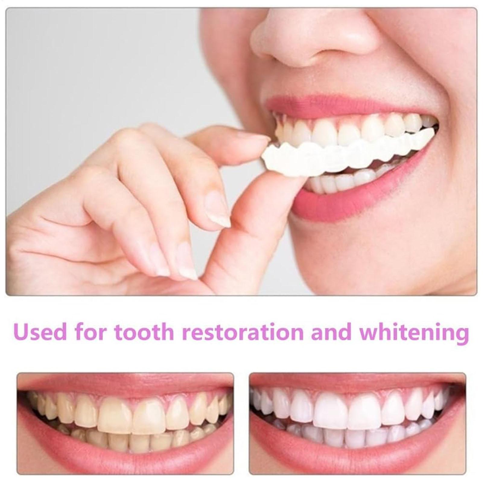 Teeth Whitening Fast - 1 çift Uzun Süreli Kaplama Diş