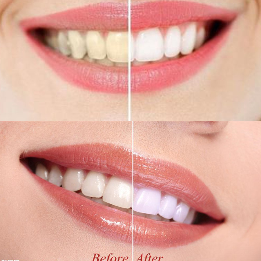 Bambu kömür diş diş diş hekimi - Teeth Whitening Co incelemesi ve fiyatı