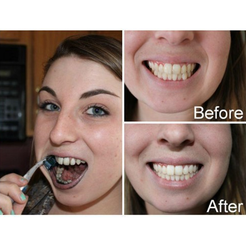 Bambu kömür diş diş diş hekimi - Teeth Whitening Co incelemesi ve fiyatı