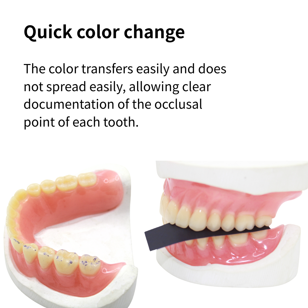 AG 300 Yaprak/Kutu Diş Artikül - Teeth Whitening Street incelemesi ve fiyatı