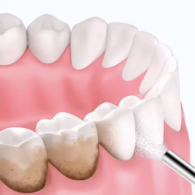 130g Diş Beyazlatma Tozu Kumla - Teeth Whitening Co incelemesi ve fiyatı